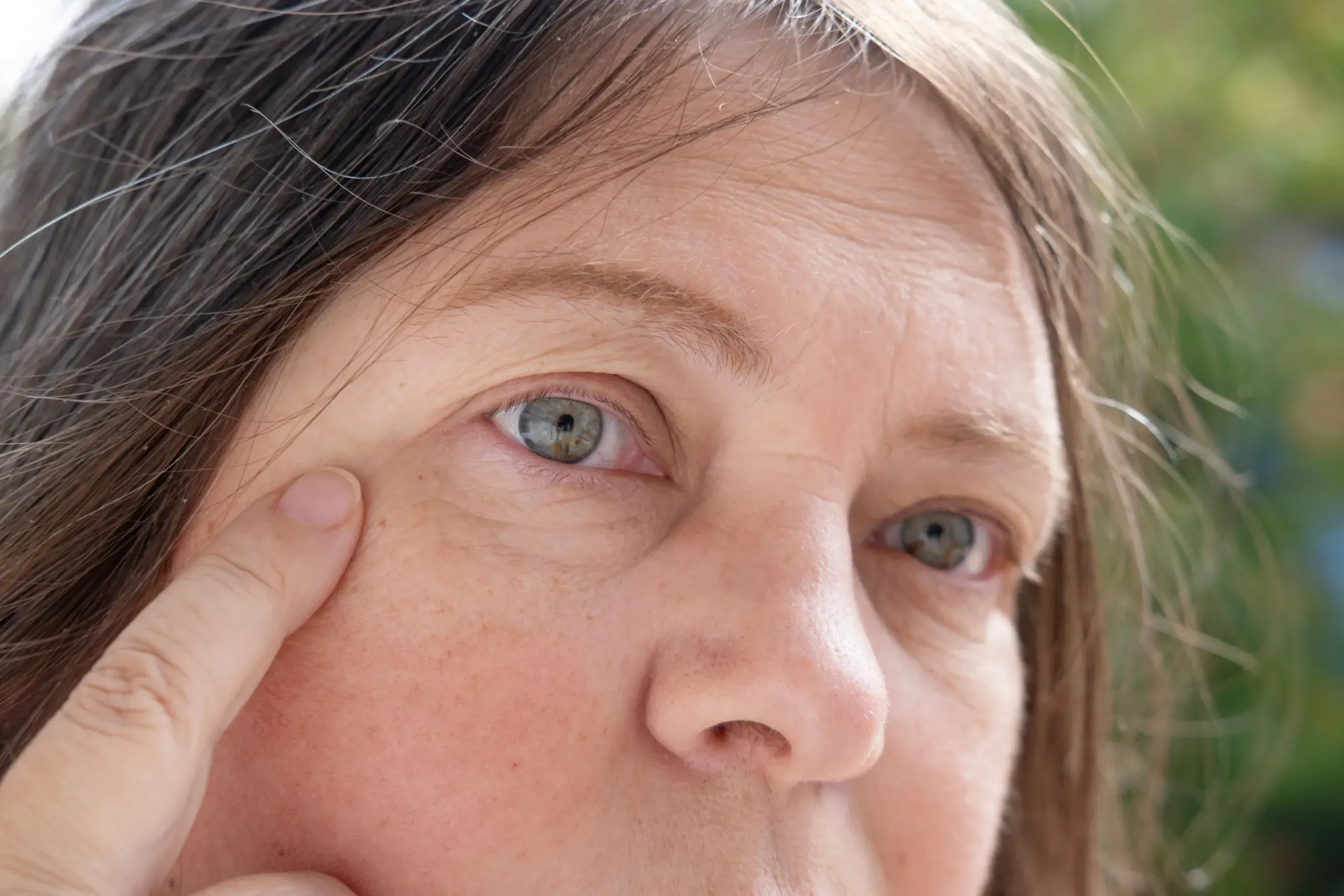 Diagram of dermal collagen and elastin structure at Hartley Health and Wellness
